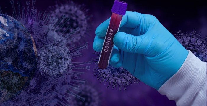  Trakų medicinos įstaigose nustatyti du COVID 19 atvejai